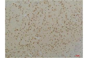 Immunohistochemistry (IHC) analysis of paraffin-embedded Mouse Brain Tissue using Cav1.