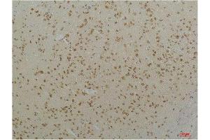 Immunohistochemistry (IHC) analysis of paraffin-embedded Mouse Brain Tissue using Cav1. (CACNA1C anticorps)