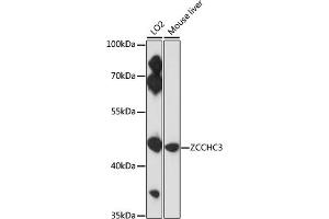 Western blot analysis of extracts of various cell lines, using ZCCHC3 antibody (ABIN7271543) at 1:3000 dilution. (ZCCHC3 anticorps  (AA 215-335))