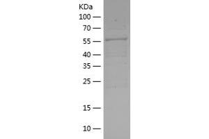 Western Blotting (WB) image for Protein Kinase, AMP-Activated, beta 2 Non-Catalytic Subunit (PRKAB2) (AA 1-272) protein (His-IF2DI Tag) (ABIN7124660) (PRKAB2 Protein (AA 1-272) (His-IF2DI Tag))