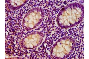 IHC image of ABIN7172046 diluted at 1:400 and staining in paraffin-embedded human appendix tissue performed on a Leica BondTM system.