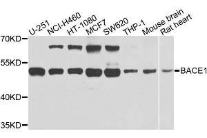 Western blot analysis of extracts of various cell lines, using BACE1 antibody. (BACE1 anticorps  (AA 22-322))