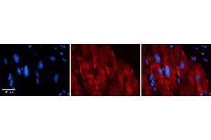 Rabbit Anti-AKAP7 Antibody    Formalin Fixed Paraffin Embedded Tissue: Human Adult heart  Observed Staining: Membrane, Cytoplasmic Primary Antibody Concentration: 1:600 Secondary Antibody: Donkey anti-Rabbit-Cy2/3 Secondary Antibody Concentration: 1:200 Magnification: 20X Exposure Time: 0. (AKAP7 anticorps  (Middle Region))