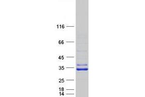 Validation with Western Blot (SIRT5 Protein (Transcript Variant 1) (Myc-DYKDDDDK Tag))