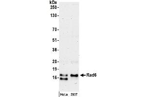 anti-Rad6 (AA 100-150) antibody