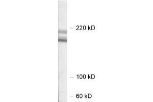 dilution: 1 : 1000, sample: rat hippocampus homogenate (SHANK2 anticorps  (AA 1042-1475))