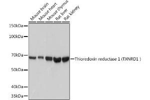 Western blot analysis of extracts of various cell lines, using Thioredoxin reductase 1 (Thioredoxin reductase 1 (TXNRD1 ) ) Rabbit mAb (ABIN7270805) at 1:1000 dilution. (TXNRD1 anticorps)