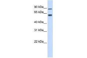 WB Suggested Anti-EFEMP1 Antibody Titration:  0. (FBLN3 anticorps  (Middle Region))
