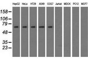 Western blot analysis of extracts (35 µg) from 9 different cell lines by using anti-SNX9 monoclonal antibody. (SNX9 anticorps)