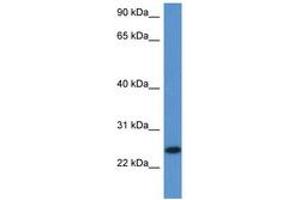 Image no. 1 for anti-Chromosome 1 Open Reading Frame 93 (C1orf93) (AA 96-145) antibody (ABIN6747236) (C1orf93 anticorps  (AA 96-145))
