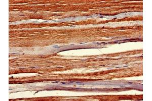 IHC image of ABIN7155848 diluted at 1:400 and staining in paraffin-embedded human skeletal muscle tissue performed on a Leica BondTM system. (SIX Homeobox 1 anticorps  (AA 144-262))