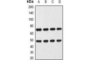 Western blot analysis of Heparanase expression in Hela (A), MCF7 (B), mouse liver (C), mouse lung (D) whole cell lysates. (HPSE anticorps)