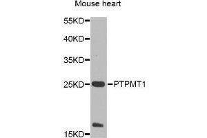 Western blot analysis of extracts of mouse heart, using PTPMT1 Antibody (ABIN5995759) at 1/1000 dilution. (PTPMT1 anticorps)
