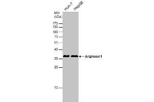 WB Image Arginase 1 antibody detects Arginase 1 protein by western blot analysis.