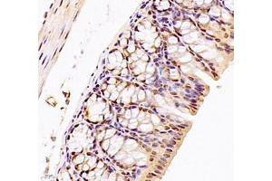 Immunohistochemistry of paraffin embedded mouse colon using DMRTA2 (ABIN7073753) at dilution of 1: 700 (400x lens)