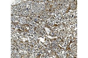 IHC analysis of COL4A3 using anti-COL4A3 antibody (ABIN7600055).
