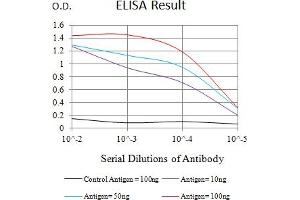 Black line: Control Antigen (100 ng),Purple line: Antigen (10 ng), Blue line: Antigen (50 ng), Red line:Antigen (100 ng)