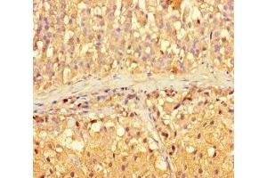 Immunohistochemistry of paraffin-embedded human adrenal gland tissue using ABIN7143489 at dilution of 1:100 (ARL16 anticorps  (AA 1-197))