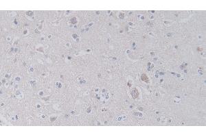 Detection of JAM2 in Human Cerebrum Tissue using Polyclonal Antibody to Junctional Adhesion Molecule 2 (JAM2)