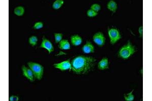 Immunofluorescent analysis of MCF-7 cells using ABIN7165150 at dilution of 1:100 and Alexa Fluor 488-congugated AffiniPure Goat Anti-Rabbit IgG(H+L)