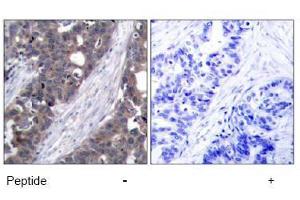 Image no. 1 for anti-Ribosomal Protein S6 Kinase, 70kDa, Polypeptide 1 (RPS6KB1) (Ser411) antibody (ABIN197526)
