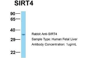 Host:  Rabbit  Target Name:  SIRT4  Sample Type:  Human Fetal Liver  Antibody Dilution:  1. (SIRT4 anticorps  (N-Term))