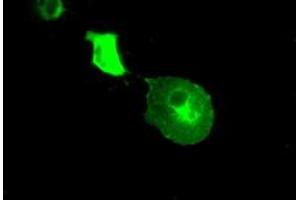 Image no. 4 for anti-Crystallin, alpha B (CRYAB) antibody (ABIN1497641) (CRYAB anticorps)