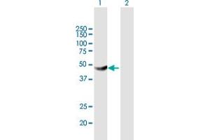 Western Blot analysis of HKDC1 expression in transfected 293T cell line by HKDC1 MaxPab polyclonal antibody. (HKDC1 anticorps  (AA 1-427))