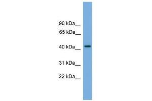 WB Suggested Anti-PALM Antibody Titration: 0. (Paralemmin anticorps  (N-Term))