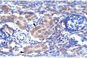 Immunohistochemical staining (Formalin-fixed paraffin-embedded sections) of human kidney with KCNAB3 polyclonal antibody  at 4-8 ug/mL working concentration.