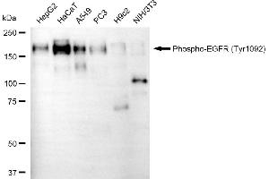 Western blotting analysis using phospho-EGFR (Tyr) antibody (ABIN7798465).