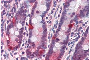 Human Small Intestine (formalin-fixed, paraffin-embedded) stained with NOD2 antibody ABIN351444 at 3 ug/ml followed by biotinylated goat anti-rabbit IgG secondary antibody ABIN481713, alkaline phosphatase-streptavidin and chromogen.
