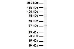 WB Suggested Anti-SIRT4 antibody Titration: 1 ug/mL Sample Type: Human Raji