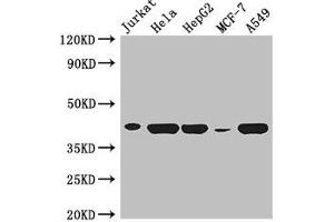 Western Blot Positive WB detected in: Jurkat whole cell lysate, Hela whole cell lysate, HepG2 whole cell lysate, MCF-7 whole cell lysate, A549 whole cell lysate All lanes: HLA-B antibody at 3 μg/mL Secondary Goat polyclonal to rabbit IgG at 1/50000 dilution Predicted band size: 41 kDa Observed band size: 41 kDa (HLA-B anticorps  (AA 25-308))