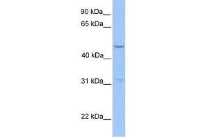 Human HepG2; WB Suggested Anti-ZNF342 Antibody Titration: 0. (Zinc Finger Protein 296 (ZNF296) (Middle Region) anticorps)