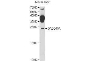 Western blot analysis of extracts of mouse liver, using GADD45A antibody (ABIN6292100) at 1:1000 dilution. (GADD45A anticorps)