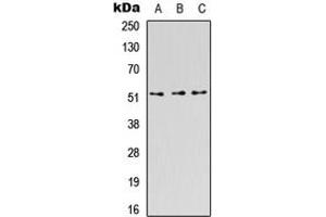 Western blot analysis of CD218b expression in HEK293T (A), Raw264. (IL18RAP anticorps  (Center))