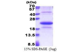 SDS-PAGE (SDS) image for Ectodysplasin A2 Receptor (EDA2R) (AA 1-138) protein (His tag) (ABIN5853331)