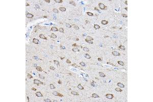 Immunohistochemistry of paraffin-embedded rat brain using PTPN23 Rabbit pAb (ABIN1682396, ABIN3019081, ABIN3019082 and ABIN6220704) at dilution of 1:100 (40x lens). (PTPN23 anticorps  (AA 1230-1450))