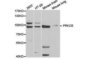 Western Blotting (WB) image for anti-Protein Kinase C, epsilon (PRKCE) antibody (ABIN1874300) (PKC epsilon anticorps)