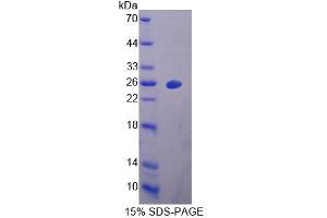 SDS-PAGE of Protein Standard from the Kit (Highly purified E. (Vitamin D-Binding Protein Kit CLIA)