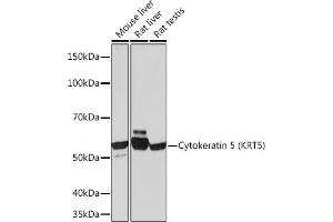 Western blot analysis of extracts of various cell lines, using Cytokeratin 5 (KRT5) (KRT5) Rabbit mAb (ABIN7268103) at 1:1000 dilution. (Cytokeratin 5 anticorps)