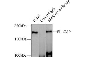 Immunoprecipitation analysis of 600 μg extracts of Mouse brain cells using 3 μg RhoGAP antibody (ABIN1682830, ABIN3016006, ABIN3016007 and ABIN7101474). (ARHGAP5 anticorps)