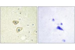 Immunohistochemistry analysis of paraffin-embedded human brain tissue, using EGFR (Ab-1016) Antibody. (EGFR anticorps  (AA 986-1035))