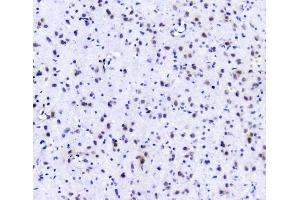 IHC analysis of POLR2A using anti-POLR2A antibody (ABIN7599598). (POLR2A/RPB1 anticorps  (AA 10-321))