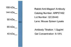 Western Blotting (WB) image for anti-Melanoma Antigen Family E, 1 (MAGEE1) (C-Term) antibody (ABIN785900) (MAGEE1 anticorps  (C-Term))