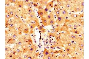 IHC image of ABIN7148285 diluted at 1:300 and staining in paraffin-embedded human liver tissue performed on a Leica BondTM system.