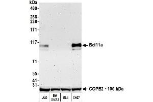 Western Blotting (WB) image for anti-B-Cell CLL/lymphoma 11A (Zinc Finger Protein) (BCL11A) (AA 1-50) antibody (ABIN7453321)