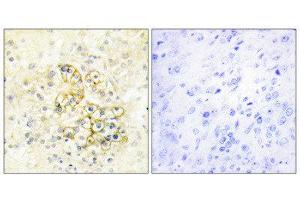 Immunohistochemistry (IHC) image for anti-Prostate Transmembrane Protein, Androgen Induced 1 (PMEPA1) (Internal Region) antibody (ABIN1849883) (PMEPA1 anticorps  (Internal Region))