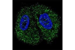 Fluorescent confocal image of MCF7 cells stained with PKM2 antibody.